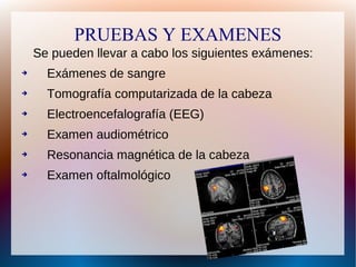 PRUEBAS Y EXAMENES
Se pueden llevar a cabo los siguientes exámenes:
➔

Exámenes de sangre

➔

Tomografía computarizada de la cabeza

➔

Electroencefalografía (EEG)

➔

Examen audiométrico

➔

Resonancia magnética de la cabeza

➔

Examen oftalmológico

 