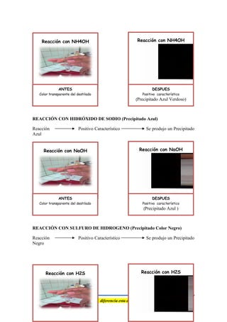 REACCIÓN CON HIDRÓXIDO DE SODIO (Precipitado Azul)
Reacción Positivo Característico Se produjo un Precipitado
Azul
REACCIÓN CON SULFURO DE HIDROGENO (Precipitado Color Negro)
Reacción Positivo Característico Se produjo un Precipitado
Negro
“Nada es veneno , Todo es veneno, La diferencia esta en la dosis”
Reacción con NH4OH
ANTES
Color transparente del destilado
Reacción con NH4OH
DESPUES
Positivo característico
(Precipitado Azul Verdoso)
Reacción con NaOH
ANTES
Color transparente del destilado
Reacción con NaOH
DESPUES
Positivo característico
(Precipitado Azul )
Reacción con H2S Reacción con H2S
 