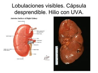 Lobulaciones visibles. Cápsula
 desprendible. Hilio con UVA.
 