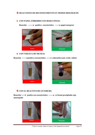 “Todo es veneno, Nada es veneno, Todo depende de la dosis“ Página 5
REACCIONES DE RECONOCIMIENTO EN MEDIOS BIOLÓGICOS
CON PAPEL EMBEBIDO CON ROJO CONGO:
Reacción positivo característico papel ennegrece
CON VIOLETA DE METILO:
Reacción positivo característico coloración azul, verde, violeta
CON EL REACTIVO DE GUNZBURG
Reacción positivo no característico se formó precipitado rojo
anaranjado
Antes
Antes Después
Antes
Después
Después
 