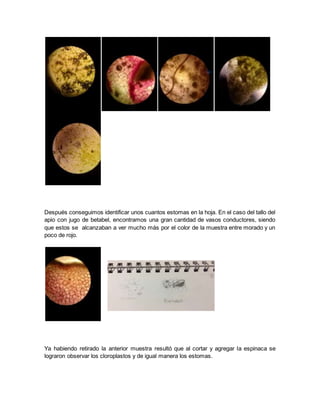 Después conseguimos identificar unos cuantos estomas en la hoja. En el caso del tallo del
apio con jugo de betabel, encontramos una gran cantidad de vasos conductores, siendo
que estos se alcanzaban a ver mucho más por el color de la muestra entre morado y un
poco de rojo.
Ya habiendo retirado la anterior muestra resultó que al cortar y agregar la espinaca se
lograron observar los cloroplastos y de igual manera los estomas.
 