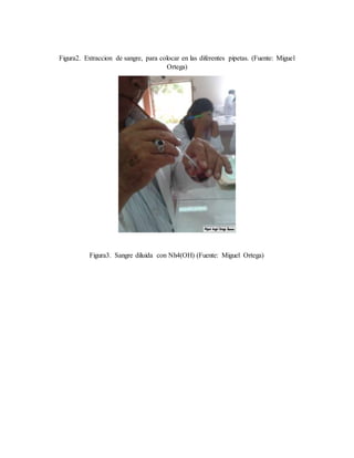 Figura2. Extraccion de sangre, para colocar en las diferentes pipetas. (Fuente: Miguel
Ortega)
Figura3. Sangre diluida con Nh4(OH) (Fuente: Miguel Ortega)
 