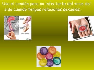 Usa el condón para no infectarte del virus del sida cuando tengas relaciones sexuales. 