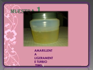 AMARILLENT
A
LIGERAMENT
E TURBIO
TIPO 1
 