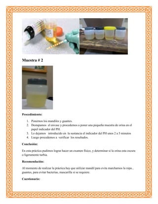 Muestra # 2
Procedimiento:
1. Ponernos los mandiles y guantes.
2. Destapamos el envase y procedemos a poner una pequeña muestra de orina en el
papel indicador del PH.
3. Lo dejamos introducido en la sustancia el indicador del PH unos 2 a 5 minutos
4. Luego procedemos a verificar los resultados.
Conclusión:
En esta práctica pudimos lograr hacer un examen físico, y determinar si la orina esta oscura
o ligeramente turbia.
Recomendación:
Al momento de realizar la práctica hay que utilizar mandil para evita marcharnos la ropa ,
guantes, para evitar bacterias, mascarilla si se requiere.
Cuestionario:
 