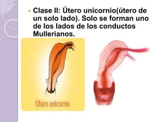  Clase II: Útero unicornio(útero de 
un solo lado). Solo se forman uno 
de los lados de los conductos 
Mullerianos. 
 