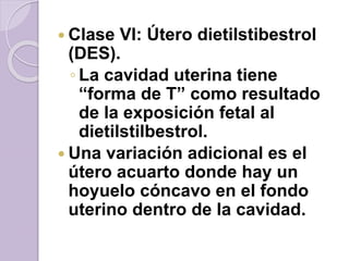 Clase VI: Útero dietilstibestrol 
(DES). 
◦ La cavidad uterina tiene 
“forma de T” como resultado 
de la exposición fetal al 
dietilstilbestrol. 
 Una variación adicional es el 
útero acuarto donde hay un 
hoyuelo cóncavo en el fondo 
uterino dentro de la cavidad. 
 
