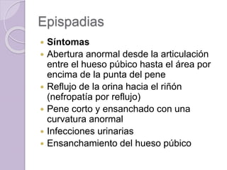 Epispadias 
 Síntomas 
 Abertura anormal desde la articulación 
entre el hueso púbico hasta el área por 
encima de la punta del pene 
 Reflujo de la orina hacia el riñón 
(nefropatía por reflujo) 
 Pene corto y ensanchado con una 
curvatura anormal 
 Infecciones urinarias 
 Ensanchamiento del hueso púbico 
 
