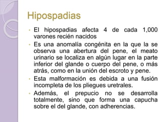 Hipospadias 
• El hipospadias afecta 4 de cada 1,000 
varones recién nacidos 
• Es una anomalía congénita en la que la se 
observa una abertura del pene, el meato 
urinario se localiza en algún lugar en la parte 
inferior del glande o cuerpo del pene, o más 
atrás, como en la unión del escroto y pene. 
• Esta malformación es debida a una fusión 
incompleta de los pliegues uretrales. 
• Además, el prepucio no se desarrolla 
totalmente, sino que forma una capucha 
sobre el del glande, con adherencias. 
 