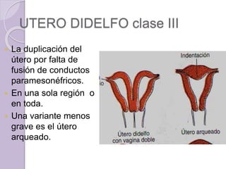 UTERO DIDELFO clase III 
 La duplicación del 
útero por falta de 
fusión de conductos 
paramesonéfricos. 
 En una sola región o 
en toda. 
 Una variante menos 
grave es el útero 
arqueado. 
 