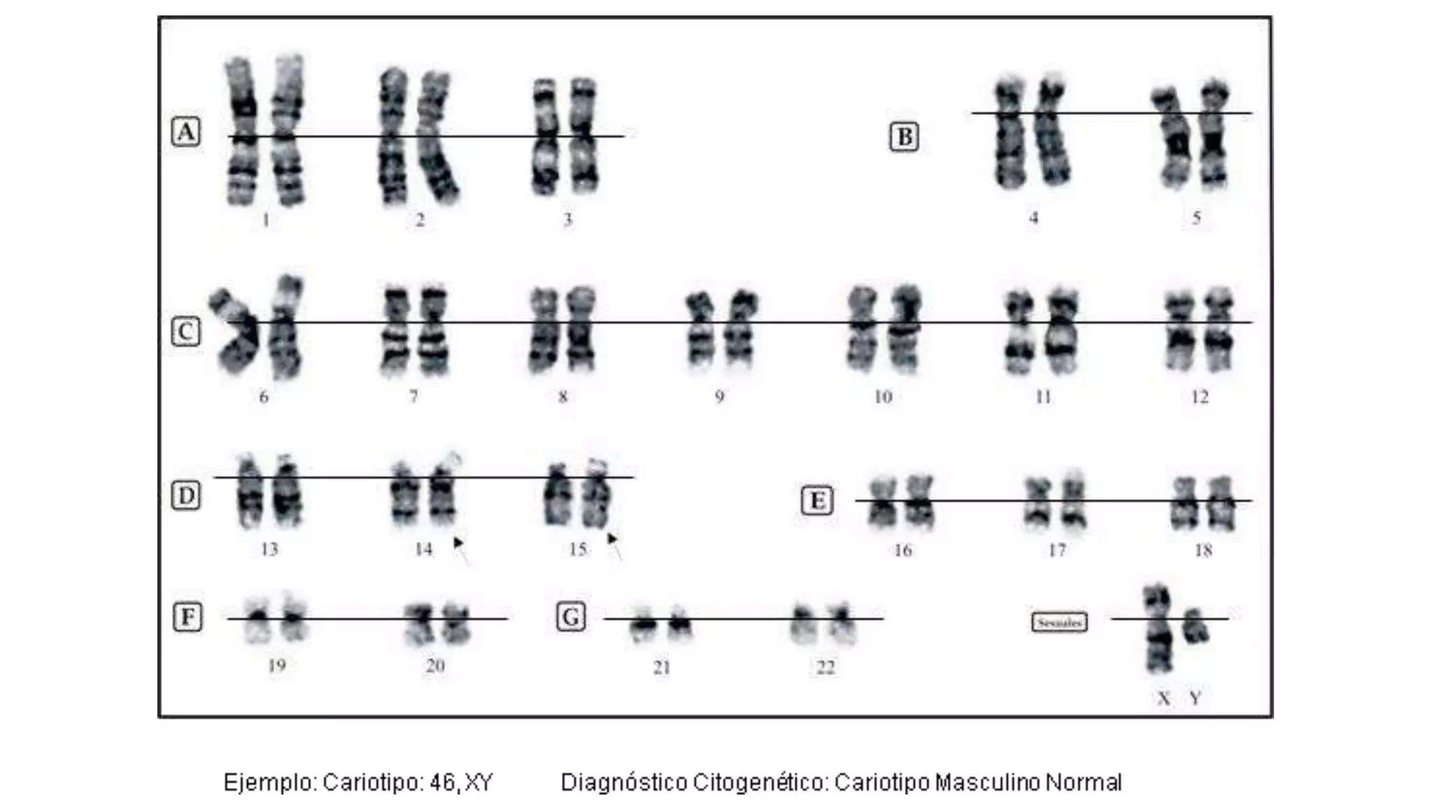 Practica 3 Elaboración del Cariograma.pptx