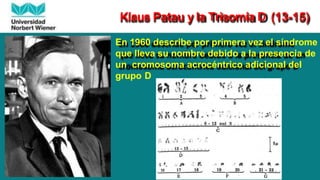 Klaus Patau y la Trisomía D (13-15)
En 1960 describe por primera vez el síndrome
que lleva su nombre debido a la presencia de
un cromosoma acrocéntrico adicional del
grupo D
 