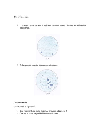 Observaciones:
1. Logramos observar en la primera muestra unos cristales en diferentes
posiciones.
2. En la segunda muestra observamos almidones.
Conclusiones:
Concluimos lo siguiente:
Que realmente se pudo observar cristales a las 3, 5, 8.
Que en la orina se pudo observar almidones.
 