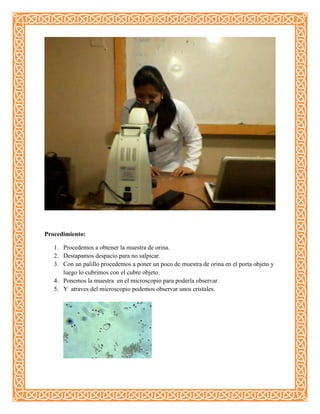 Procedimiento:
1. Procedemos a obtener la muestra de orina.
2. Destapamos despacio para no salpicar.
3. Con un palillo procedemos a poner un poco de muestra de orina en el porta objeto y
luego lo cubrimos con el cubre objeto.
4. Ponemos la muestra en el microscopio para poderla observar.
5. Y atraves del microscopio podemos observar unos cristales.
 
