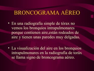 BRONCOGRAMA AÉREO En una radiografía simple de tórax no vemos los bronquios intrapulmonares porque contienen aire,están rodeados de aire y tienen unas paredes muy delgadas. La visualización del aire en los bronquios intrapulmonares en la radiografía de toráx se llama signo de broncograma aéreo. 