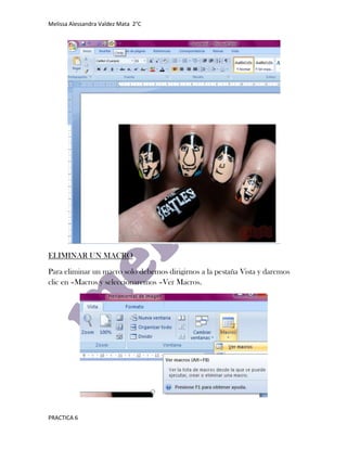 Melissa Alessandra Valdez Mata 2°C




ELIMINAR UN MACRO

Para eliminar un macro solo debemos dirigirnos a la pestaña Vista y daremos
clic en –Macros y seleccionaremos –Ver Macros.




PRACTICA 6
 