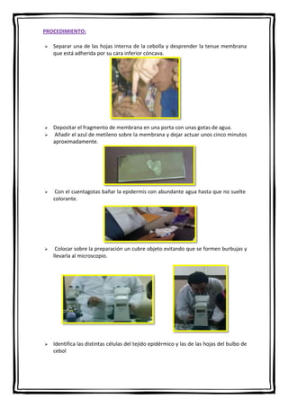 PROCEDIMIENTO:


Separar una de las hojas interna de la cebolla y desprender la tenue membrana
que está adherida por su cara inferior cóncava.



Depositar el fragmento de membrana en una porta con unas gotas de agua.
Añadir el azul de metileno sobre la membrana y dejar actuar unos cinco minutos
aproximadamente.





Con el cuentagotas bañar la epidermis con abundante agua hasta que no suelte
colorante.



Colocar sobre la preparación un cubre objeto evitando que se formen burbujas y
llevarla al microscopio.



Identifica las distintas células del tejido epidérmico y las de las hojas del bulbo de
cebol

 