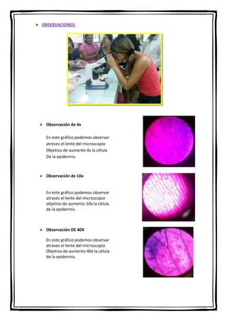  OBSERVACIONES:

 Observación de 4x
En este gráfico podemos observar
atreves el lente del microscopio
Objetivo de aumento 4x la célula
De la epidermis.

 Observación de 10x

En este gráfico podemos observar
atraves el lente del microscopio
objetivo de aumento 10x la célula
de la epidermis.

 Observación DE 40X
En este gráfico podemos observar
atraves el lente del microscopio
Objetivo de aumento 40x la célula
de la epidermis.

 