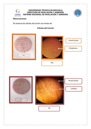 UNIVERSIDAD TÉCNICA DE MACHALA
DIRECCIÓN DE NIVELACIÓN Y ADMISIÓN
SISTEMA NACIONAL DE NIVELACIÓN Y ADMISIÓN
Observaciones:
Se observó las células del corcho con lentes de:
Células del Corcho

Pared Celular

Citoplasma

40x

Pared Celular

Celdillas

10x

 