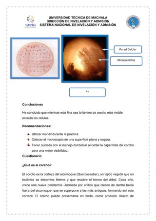 UNIVERSIDAD TÉCNICA DE MACHALA
DIRECCIÓN DE NIVELACIÓN Y ADMISIÓN
SISTEMA NACIONAL DE NIVELACIÓN Y ADMISIÓN

Pared Celular
Microceldillas

4x

Conclusiones
He concluido que mientras más fina sea la lámina de corcho más visible
estarán las células.
Recomendaciones:
Utilizar mandil durante la práctica.
Colocar el microscopio en una superficie plana y segura.
Tener cuidado con el manejo del bisturí al cortar la capa finita del corcho
para una mejor visibilidad.
Cuestionario
¿Qué es el corcho?
El corcho es la corteza del alcornoque (Quercussuber), un tejido vegetal que en
botánica se denomina felema y que recubre el tronco del árbol. Cada año,
crece una nueva peridermis –formada por anillos que crecen de dentro hacia
fuera del alcornoque- que se superpone a las más antiguas, formando así esta
corteza. El corcho puede presentarse en bruto, como producto directo de

 