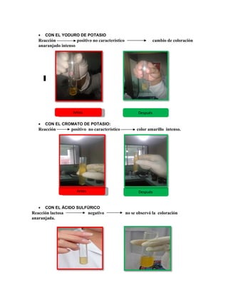 • CON EL YODURO DE POTASIO
Reacción positivo no característico cambio de coloración
anaranjado intenso
• CON EL CROMATO DE POTASIO:
Reacción positivo no característico color amarillo intenso.
• CON EL ÁCIDO SULFÚRICO
Reacción lactosa negativo no se observó la coloración
anaranjada.
AntesAntes Después
DespuésAntesAntes
 