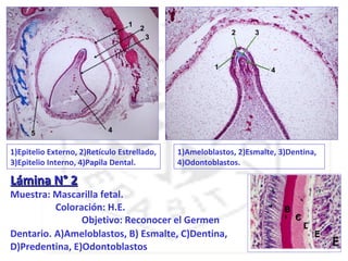 1)Epitelio Externo, 2)Retículo Estrellado,   1)Ameloblastos, 2)Esmalte, 3)Dentina,
3)Epitelio Interno, 4)Papila Dental.         4)Odontoblastos.

Lámina N° 2
Muestra: Mascarilla fetal.
          Coloración: H.E.                                           A
                                                                         B
                Objetivo: Reconocer el Germen                                C
                                                                                 D
Dentario. A)Ameloblastos, B) Esmalte, C)Dentina,                                     E
D)Predentina, E)Odontoblastos
 