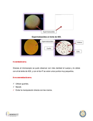 Espermatozoides

Espermatozoides en lente de 40X.
Espermatozoides

Cabeza

Cuello
Cola

Conclusiones:

Gracias al microscopio se pudo observar con más claridad el cuerpo y la célula
con el de lente de 40X, y con el de 4ª se veían unos puntos muy pequeños.
Recomendaciones:

 Utilizar guantes.
 Mandil.
 Evitar la manipulación directa con las manos.

 