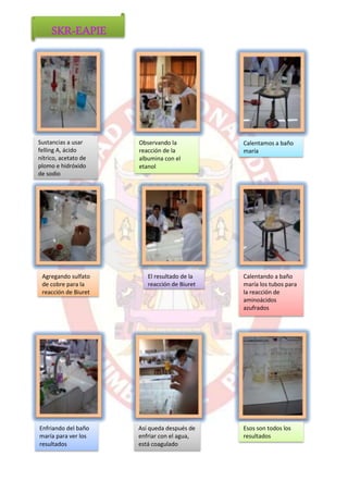 SKR-EAPIE 
Sustancias a usar 
felling A, ácido 
nítrico, acetato de 
plomo e hidróxido 
de sodio 
Observando la 
reacción de la 
albumina con el 
etanol 
Calentamos a baño 
maría 
Agregando sulfato 
de cobre para la 
reacción de Biuret 
Enfriando del baño 
maría para ver los 
resultados 
El resultado de la 
reacción de Biuret 
Así queda después de 
enfriar con el agua, 
está coagulado 
Calentando a baño 
maría los tubos para 
la reacción de 
aminoácidos 
azufrados 
Esos son todos los 
resultados 
 