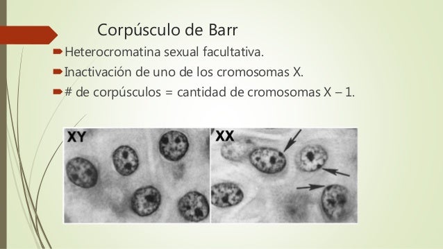 corpusculo de barr