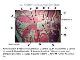 A: Ventriculo D.B: Tabique interventricularC: Ventric. Izq. D: Valvula mitral E: ValvulatricuspideF: AlmoadillasEndoc. G: Auricula derecha H: Tabique interauricular I: Bronquios principales J: EsofagoK: Cuerpo vertebral L: AortaM: Pulmón N: Auricula Izq.
