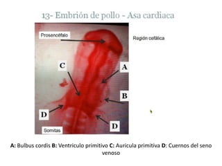A: Bulbuscordis B: Ventriculo primitivo C: Auricula primitiva D: Cuernos del seno venoso