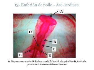 A: Neuroporo anterior B: BulbuscordisC: Ventriculo primitivo D: Auricula primitiva E: Cuernos del seno venoso