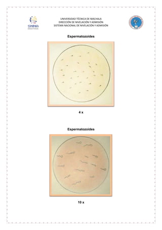 UNIVERSIDAD TÉCNICA DE MACHALA
DIRECCIÓN DE NIVELACIÓN Y ADMISIÓN
SISTEMA NACIONAL DE NIVELACIÓN Y ADMISIÓN

Espermatozoides

4x

Espermatozoides

10 x

 