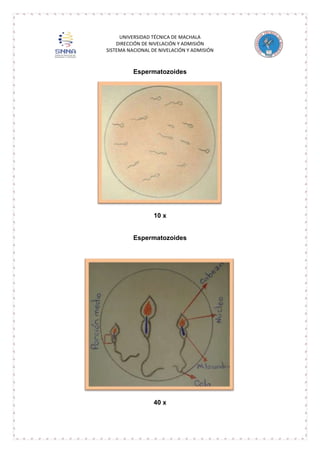 UNIVERSIDAD TÉCNICA DE MACHALA
DIRECCIÓN DE NIVELACIÓN Y ADMISIÓN
SISTEMA NACIONAL DE NIVELACIÓN Y ADMISIÓN

Espermatozoides

10 x

Espermatozoides

40 x

 