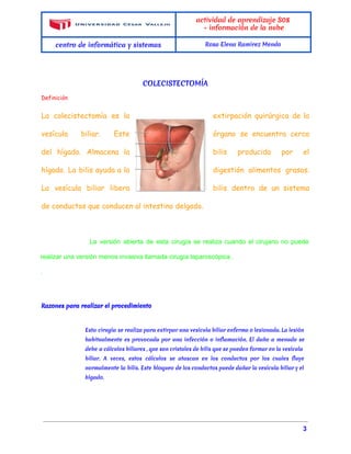  
 
actividad de aprendizaje S08
- información de la nube
centro de informática y sistemas Rosa Elena Ramirez Mendo
 
COLECISTECTOMÍA
Definición
 
La colecistectomía es la extirpación quirúrgica de la
vesícula biliar. Este órgano se encuentra cerca
del hígado. Almacena la bilis producida por el
hígado. La bilis ayuda a la digestión alimentos grasos.
La vesícula biliar libera bilis dentro de un sistema
de conductos que conducen al intestino delgado.
La versión abierta de esta cirugía se realiza cuando el cirujano no puede                         
realizar una versión menos invasiva llamada​ cirugía laparoscópica​ . 
.   
*
Razones para realizar el procedimiento
Esta cirugía se realiza para extirpar una vesícula biliar enferma o lesionada. La lesión
habitualmente es provocada por una infección o inflamación. El daño a menudo se
debe a cálculos biliares , que son cristales de bilis que se pueden formar en la vesícula
biliar. A veces, estos cálculos se atascan en los conductos por los cuales fluye
normalmente la bilis. Este bloqueo de los conductos puede dañar la vesícula biliar y el
hígado.
 
                                                                                                                                                 ​ 3 
 
 