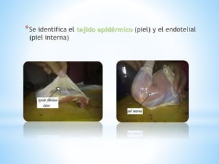 *Se identifica el tejido epidérmico (piel) y el endotelial
(piel interna)
 