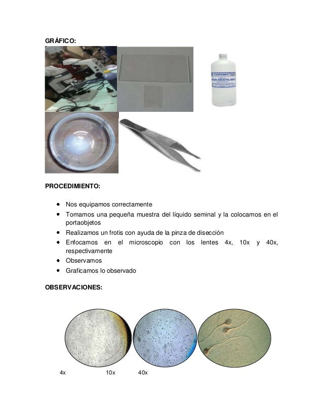 Practica Observación De Espermatozoides