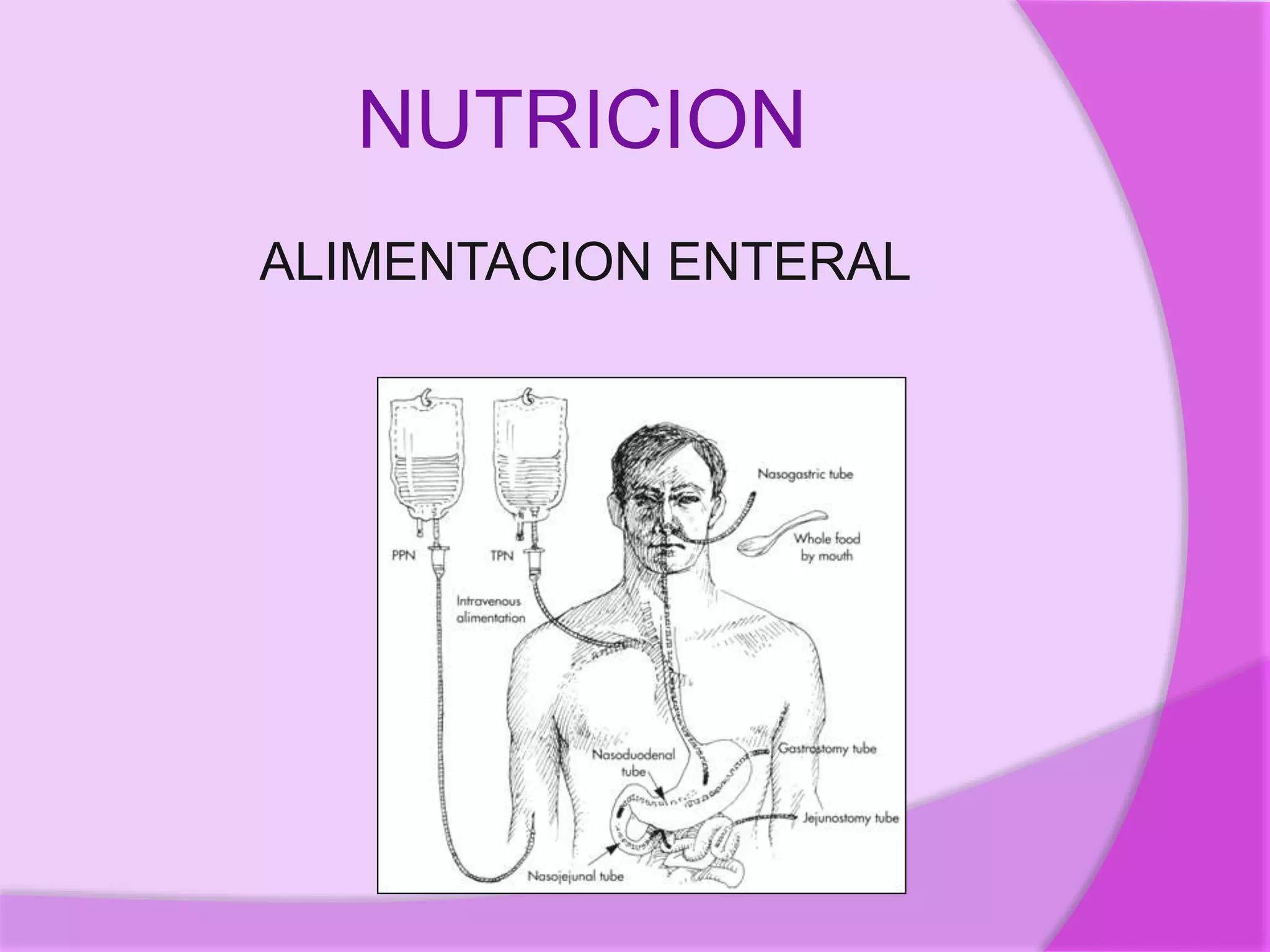 NUTRICION
ALIMENTACION ENTERAL
