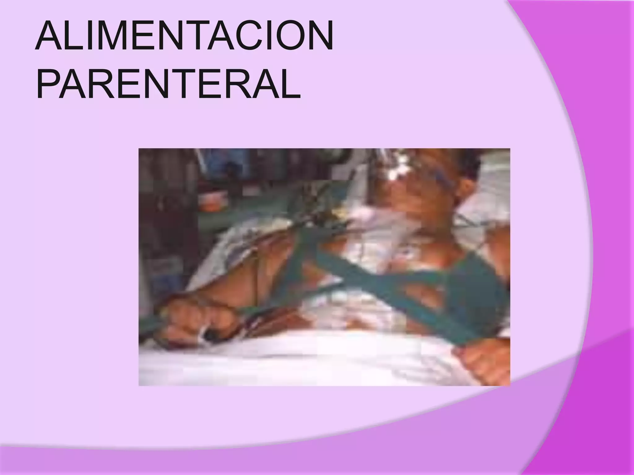 ALIMENTACION
PARENTERAL