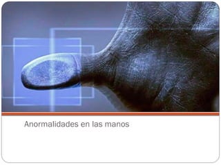 Anormalidades en las manos
 