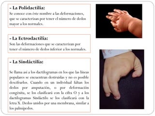 - La Polidactilia:
Se conoce con éste nombre a las deformaciones,
que se caracterizan por tener el número de dedos
mayor a los normales.
- La Ectrodactilia:
Son las deformaciones que se caracterizan por
tener el número de dedos inferior a los normales.
- La Sindáctilia:
Se llama así a los dactilogramas en los que las líneas
populares se encuentran destruidas y no es posible
descifrarlos. Cuando en un individual faltan los
dedos por amputación, o por deformación
congénita, se los clasificará con la cifra O y a los
dactilogramas Sindáctilo se los clasificará con la
letra X. Dedos unidos por una membrana, similar a
los palmípedos.
 