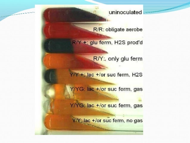 triple sugar test in microbiology essay Buy and get information for triple sugar iron agar, m021, microbiology, dehydrated culture media, biochemical identification media, animal based media. triple sugar test in microbiology essay Buy and get information for triple sugar iron agar, m021, microbiology, dehydrated culture media, biochemical identification media, animal based media.