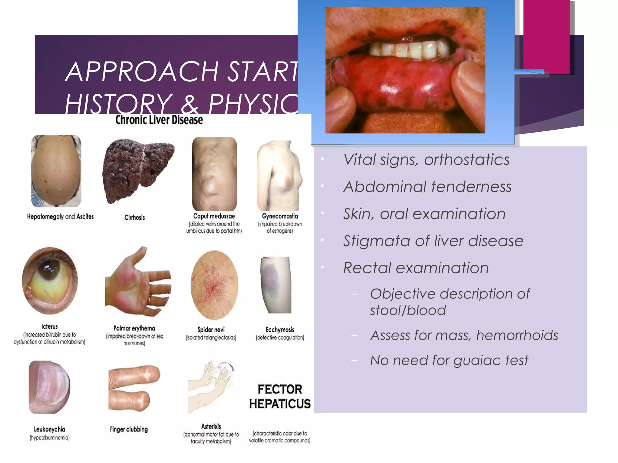 APPROACH STARTS FROM
HISTORY & PHYSICAL EXAM
History
 Localizing symptoms
 History of prior GIB
 NSAID/aspirin use
 Liver disease/cirrhosis
 Vascular disease
 Aortic valvular disease, chronic
renal failure
 AAA repair
 Radiation exposure
 Family history of GIB
Physical
Examination
• Vital signs, orthostatics
• Abdominal tenderness
• Skin, oral examination
• Stigmata of liver disease
• Rectal examination
– Objective description of
stool/blood
– Assess for mass, hemorrhoids
– No need for guaiac test
 