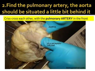 Criss-cross each other, with the pulmonary ARTERY in the front
 