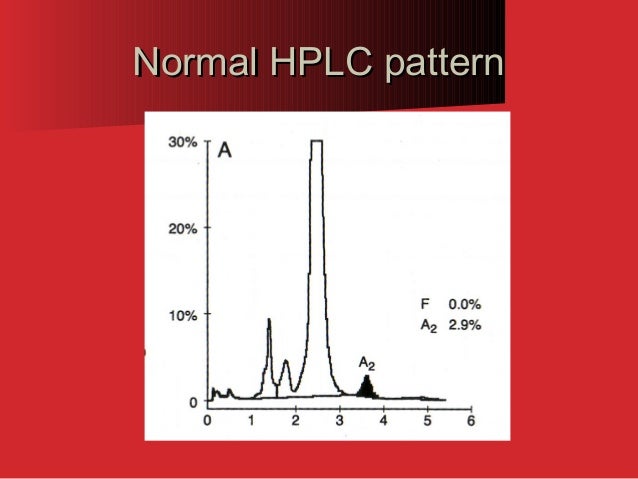 Hemoglobin C Disease Electrophoresis Hemoglobin Electrophoresis Biochemistry Hemoglobin C Disease Electrophoresis Hemoglobin Electrophoresis Biochemistry