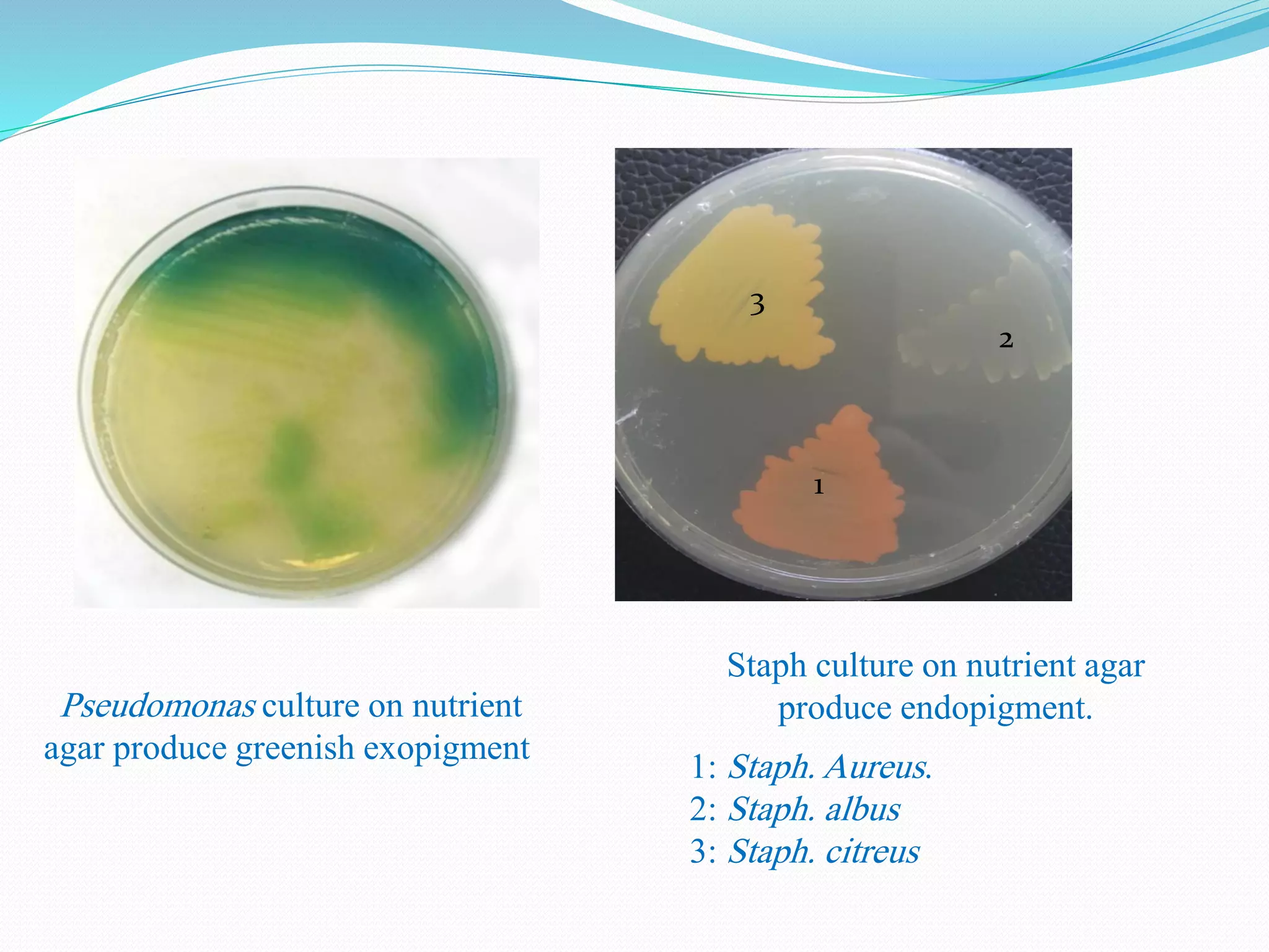 Pseudomonas culture on nutrient
agar produce greenish exopigment.
Staph culture on nutrient agar
produce endopigment.
1: Staph. Aureus.
2: Staph. albus
3: Staph. citreus
1
2
3
 