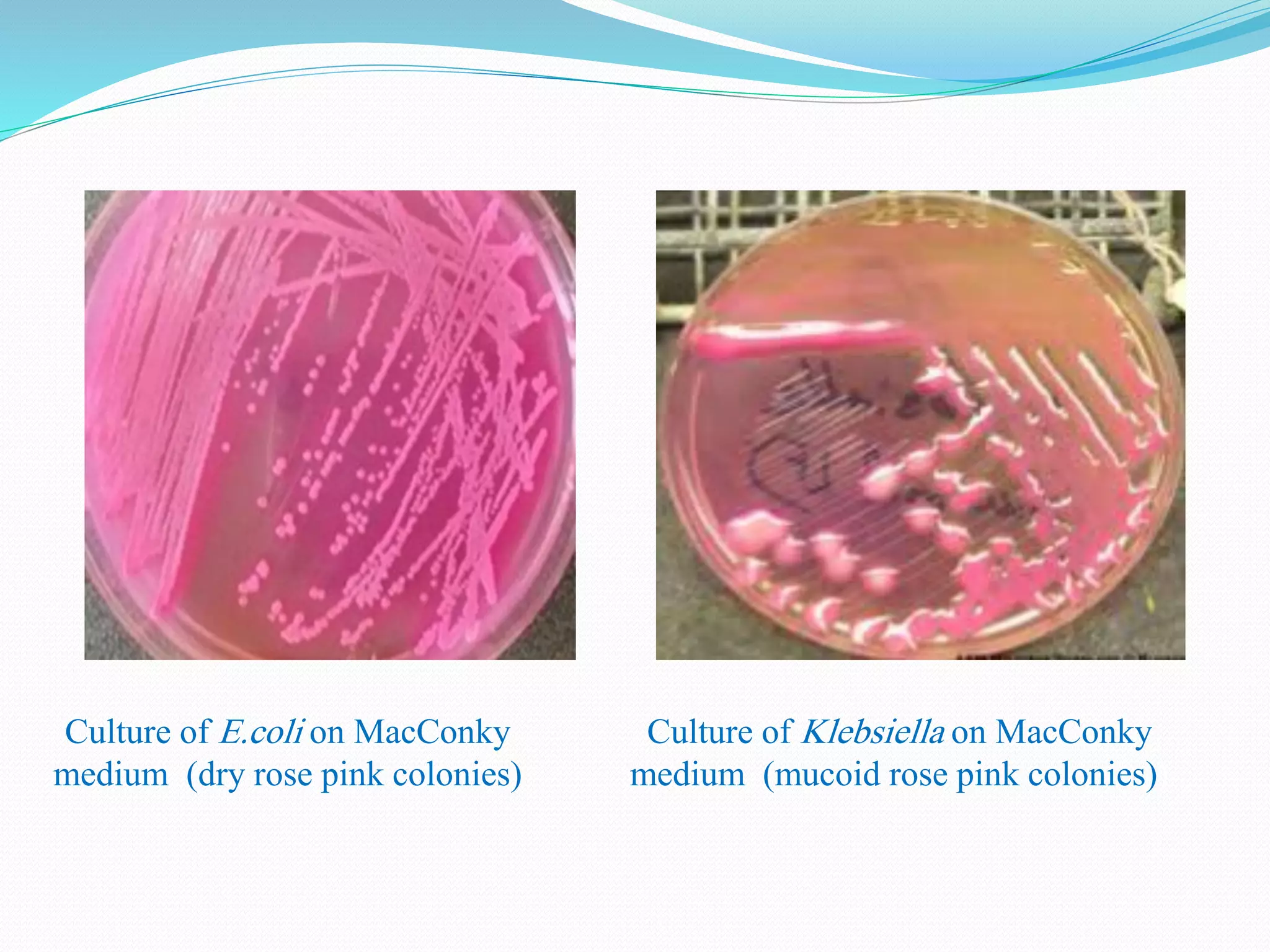 Culture of E.coli on MacConky
medium (dry rose pink colonies)
Culture of Klebsiella on MacConky
medium (mucoid rose pink colonies))
 
