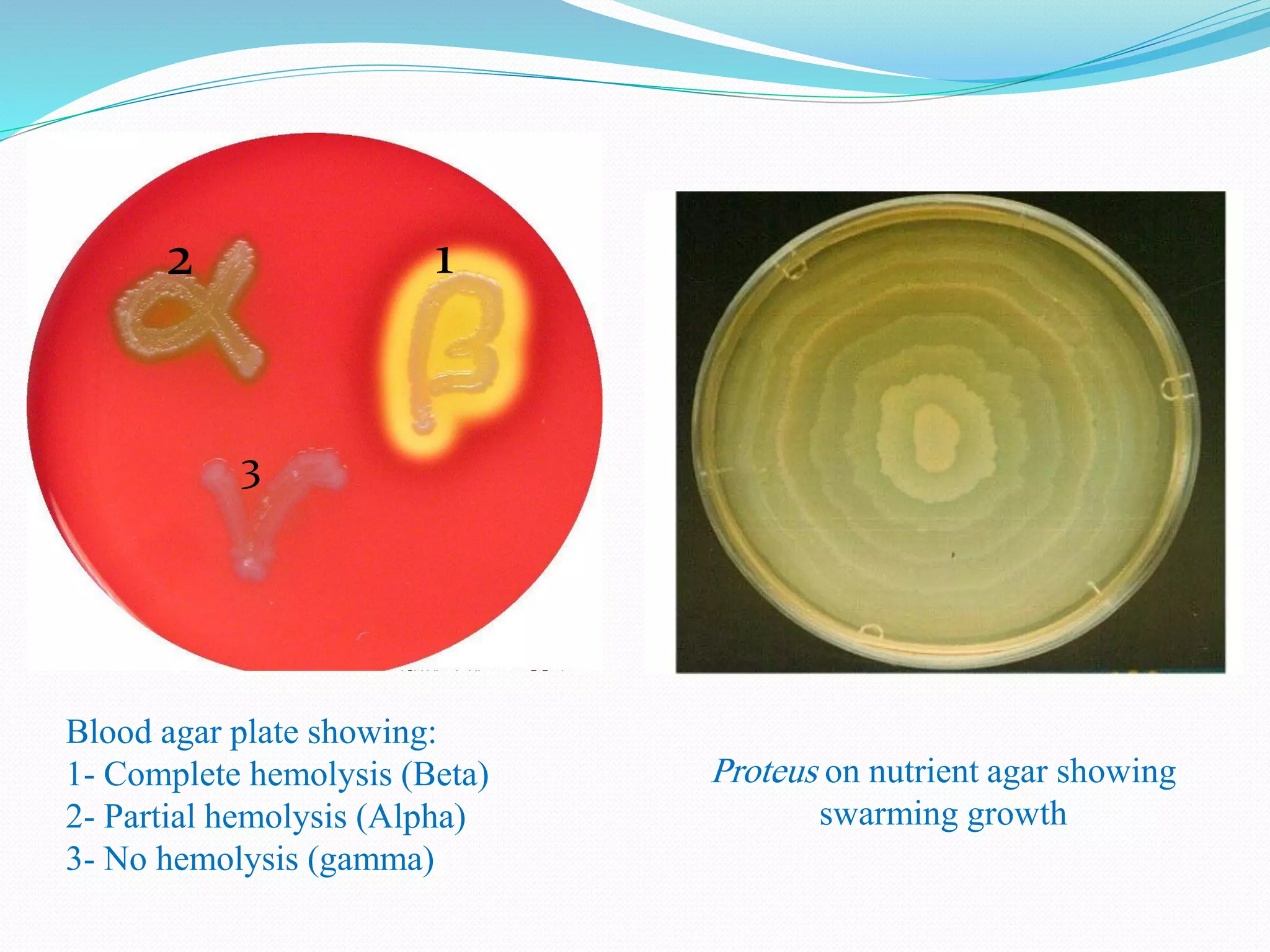 1
3
2
Proteus on nutrient agar showing
swarming growth
Blood agar plate showing:
1- Complete hemolysis (Beta)
2- Partial hemolysis (Alpha)
3- No hemolysis (gamma))
 