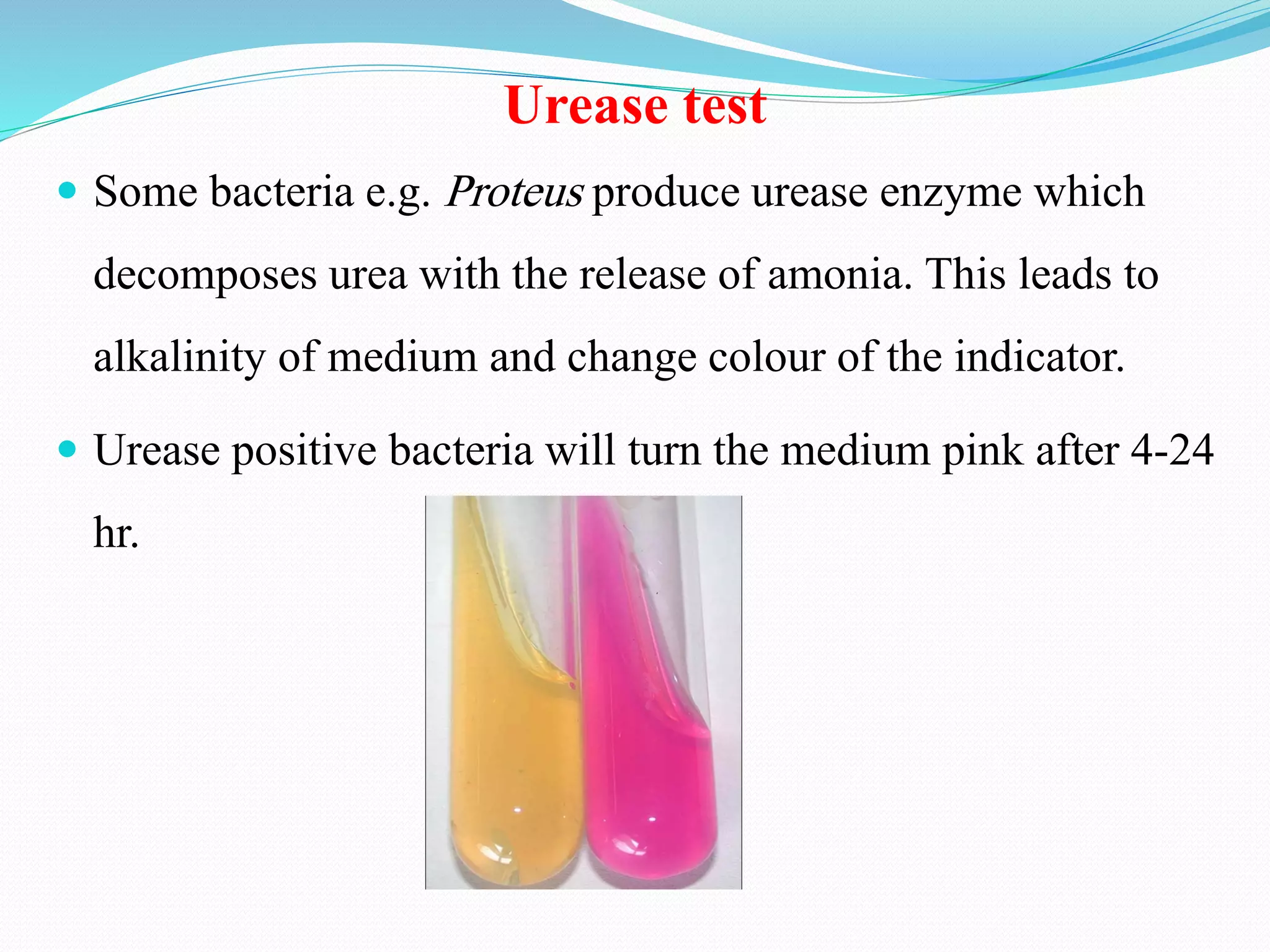 Urease test
 Some bacteria e.g. Proteus produce urease enzyme which
decomposes urea with the release of amonia. This leads to
alkalinity of medium and change colour of the indicator.
 Urease positive bacteria will turn the medium pink after 4-24
hr.
 