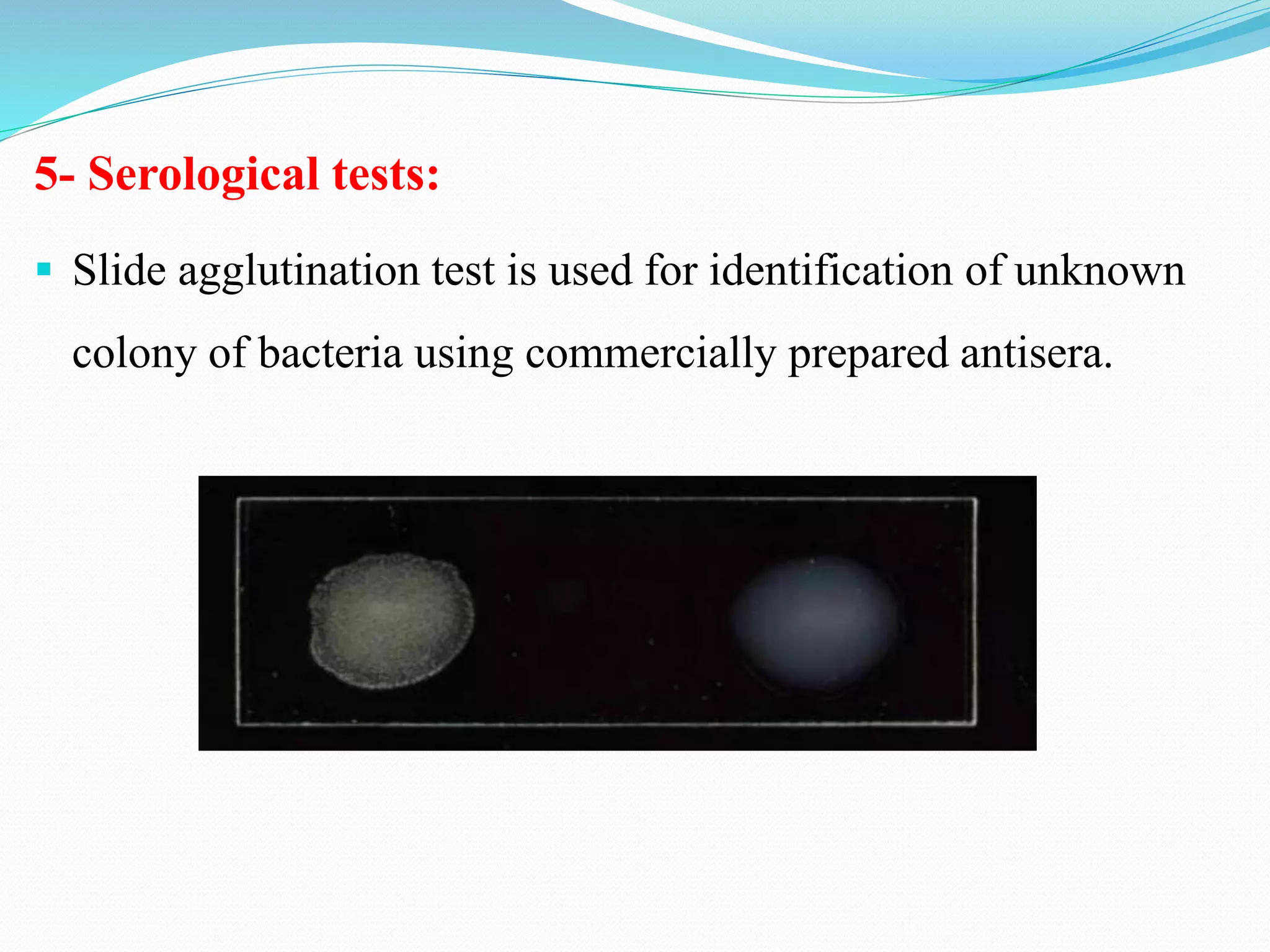 5- Serological tests:
▪ Slide agglutination test is used for identification of unknown
colony of bacteria using commercially prepared antisera.
 